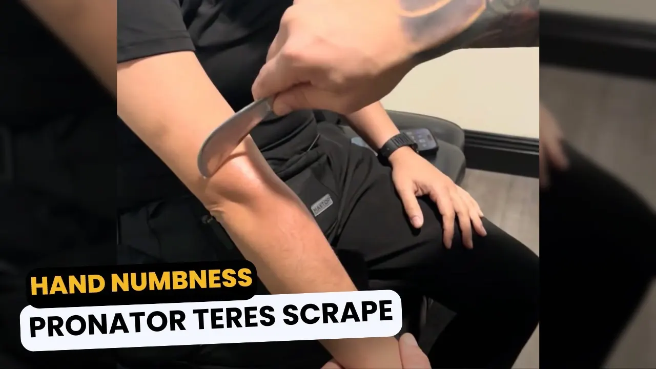 Pronator Teres – Hand Numbess Relief!