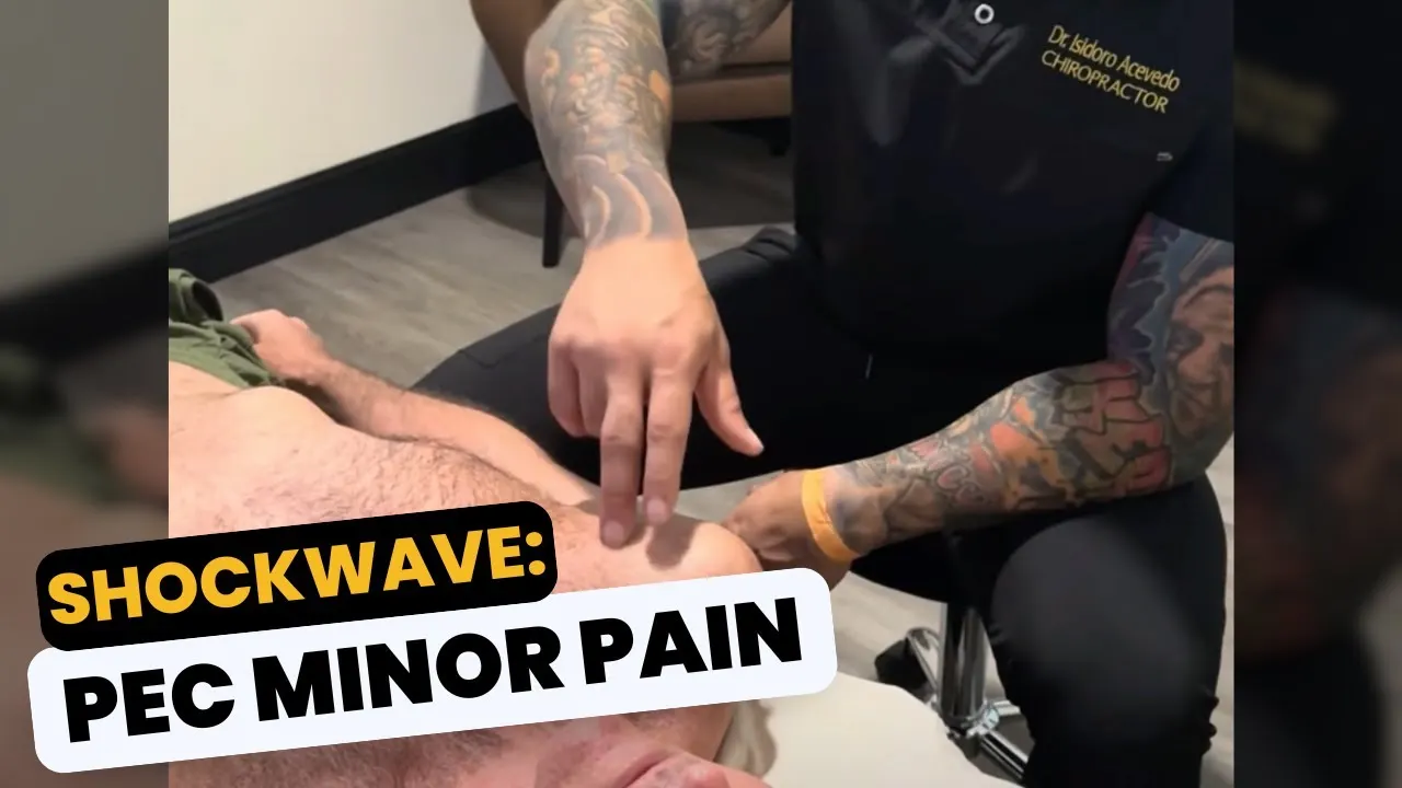 Pec Minor Shockwave Treatment