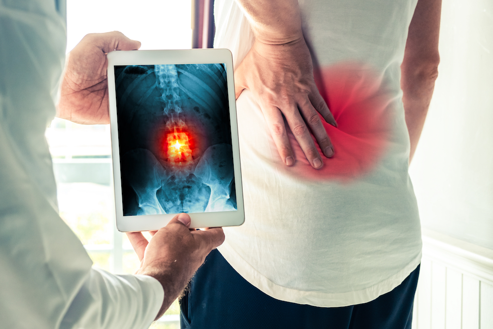 spine x-ray on patient in Cocoa